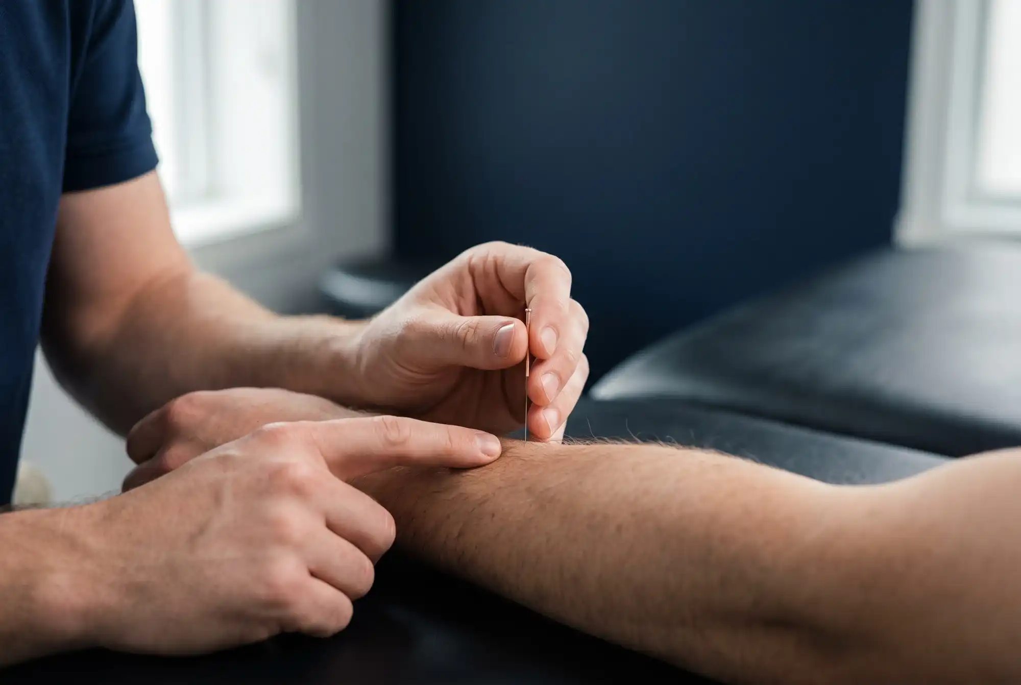 Dry needling in de onderarm.